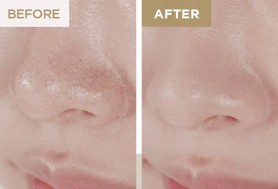 SKIN1004 Madagascar Centella Double Cleansing Duo